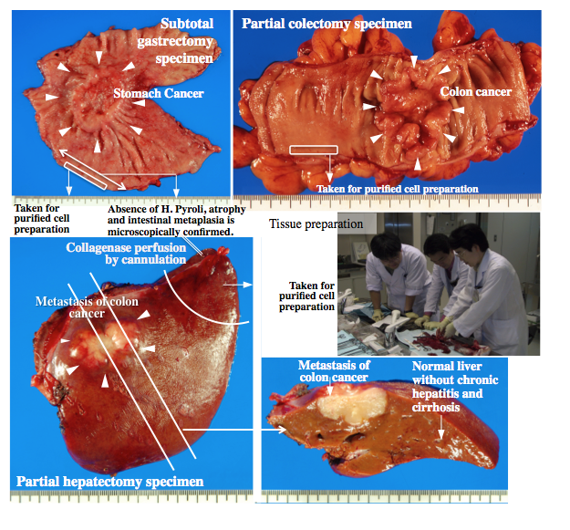 Figure 1 Surgically resected materials